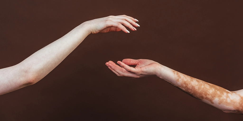 Two hands reaching out to each other against a plain background, symbolizing connection and support for individuals with autism.